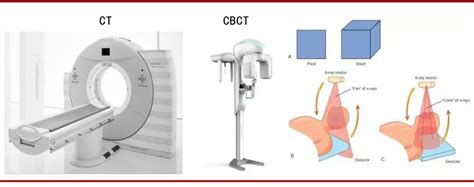 الفرق بين ct و cbct|Cone Beam CT vs. Traditional CT: Why CBCT Is Ideal for Your .